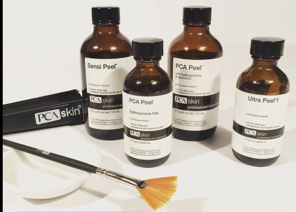 TCA chemical peel