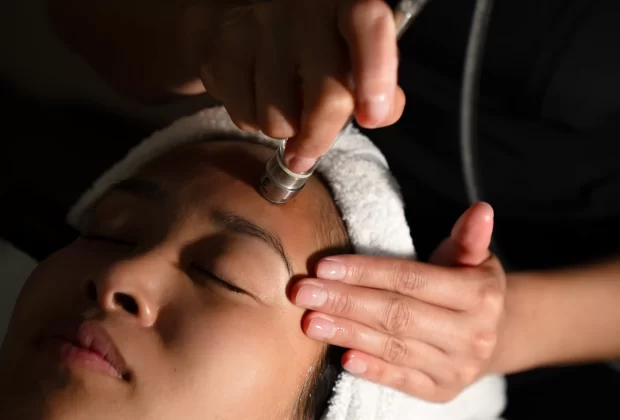 Microdermabrasion treatment
